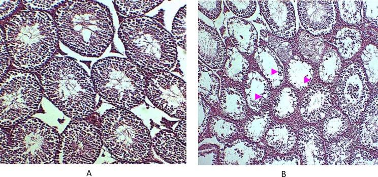 https://cdn.ncbi.nlm.nih.gov/pmc/blobs/82e2/4169678/31c66a2b11b5/ijrm-10-419-g002.jpg