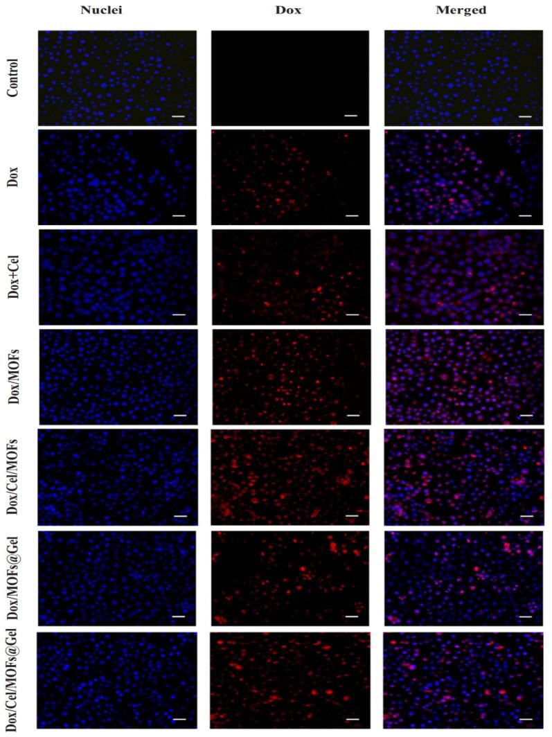 https://cdn.ncbi.nlm.nih.gov/pmc/blobs/82e4/10342828/652534bda227/materials-16-04685-g003.jpg