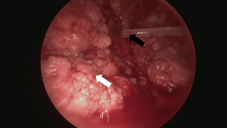 https://cdn.ncbi.nlm.nih.gov/pmc/blobs/82ec/12086292/3f675cf10bda/cureus-0017-00000082551-i04.jpg