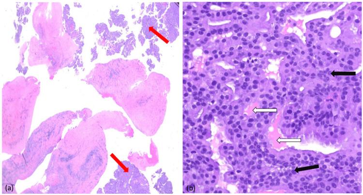 https://cdn.ncbi.nlm.nih.gov/pmc/blobs/82ec/12086292/a18568c27330/cureus-0017-00000082551-i05.jpg