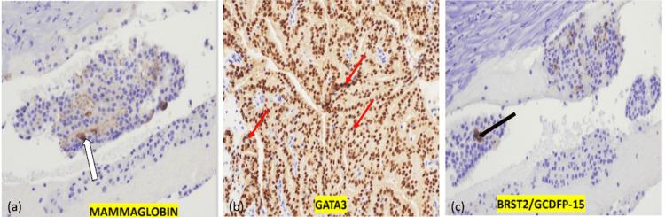 https://cdn.ncbi.nlm.nih.gov/pmc/blobs/82ec/12086292/c2bb97029d13/cureus-0017-00000082551-i06.jpg