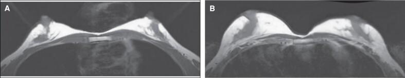 https://cdn.ncbi.nlm.nih.gov/pmc/blobs/82ed/11852245/bee06105bfde/ojae087f2.jpg
