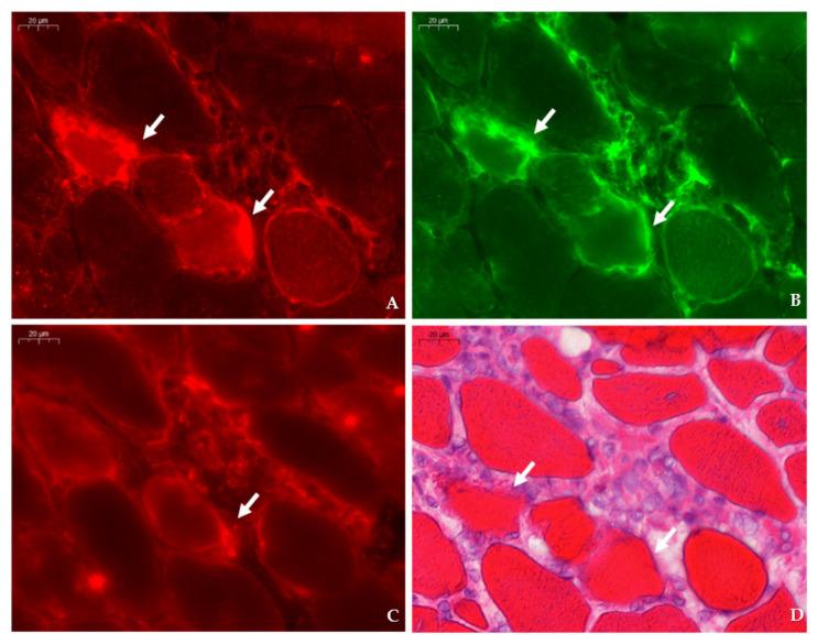https://cdn.ncbi.nlm.nih.gov/pmc/blobs/82ed/8955384/858448ef6de7/ijms-23-03251-g004.jpg