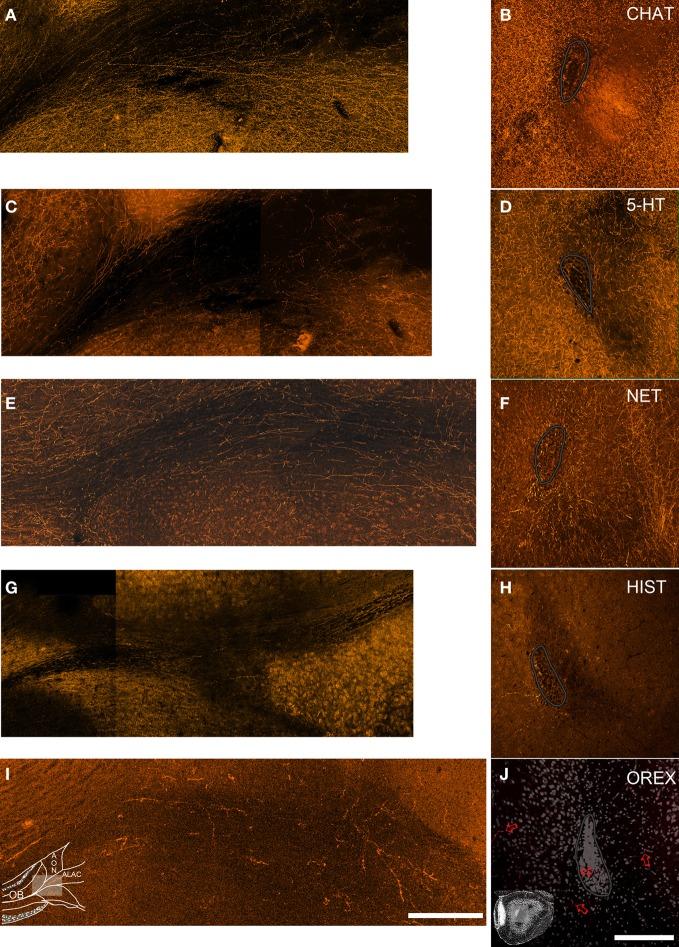 https://cdn.ncbi.nlm.nih.gov/pmc/blobs/82f0/3555037/7cdf7074ffe1/fnana-06-00051-g0003.jpg