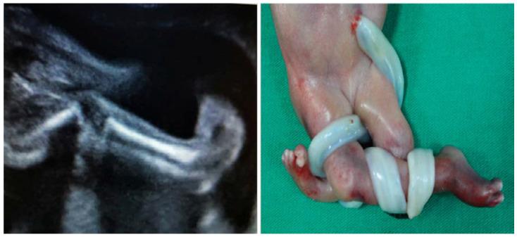 https://cdn.ncbi.nlm.nih.gov/pmc/blobs/82fc/7459488/8af189a0d39d/diagnostics-10-00583-g004.jpg