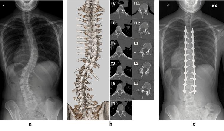 https://cdn.ncbi.nlm.nih.gov/pmc/blobs/82fd/11133951/2c6c1ffdf804/cureus-0016-00000059240-i01.jpg
