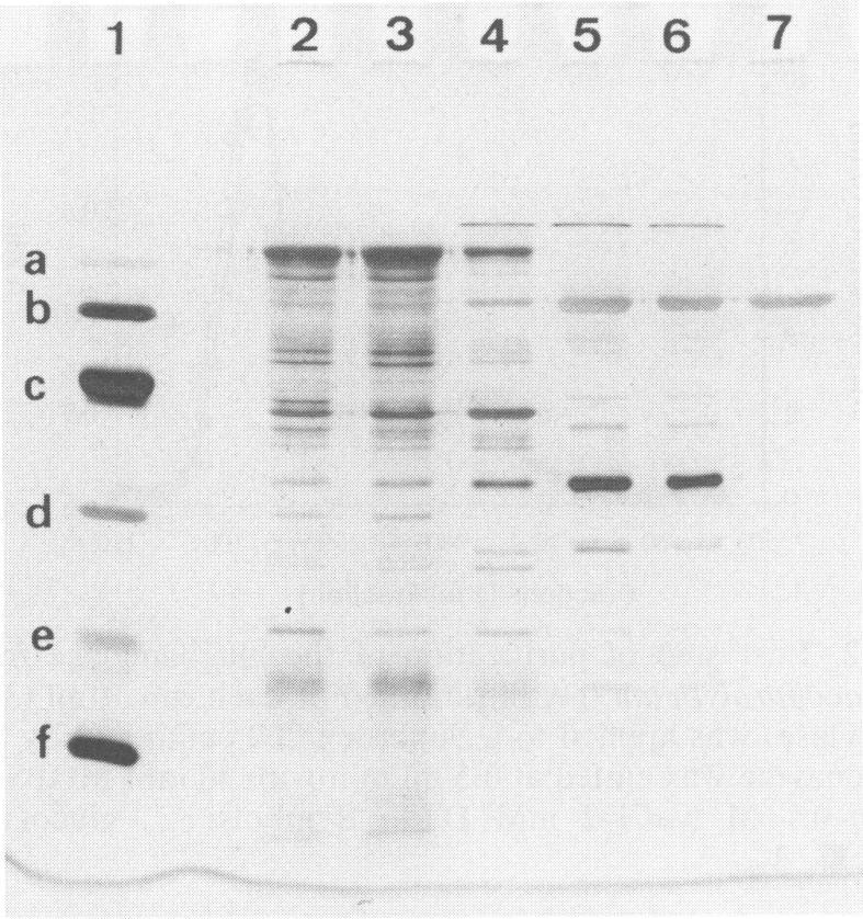 https://cdn.ncbi.nlm.nih.gov/pmc/blobs/82ff/183570/5effb836bc4a/aem00061-0220-a.jpg