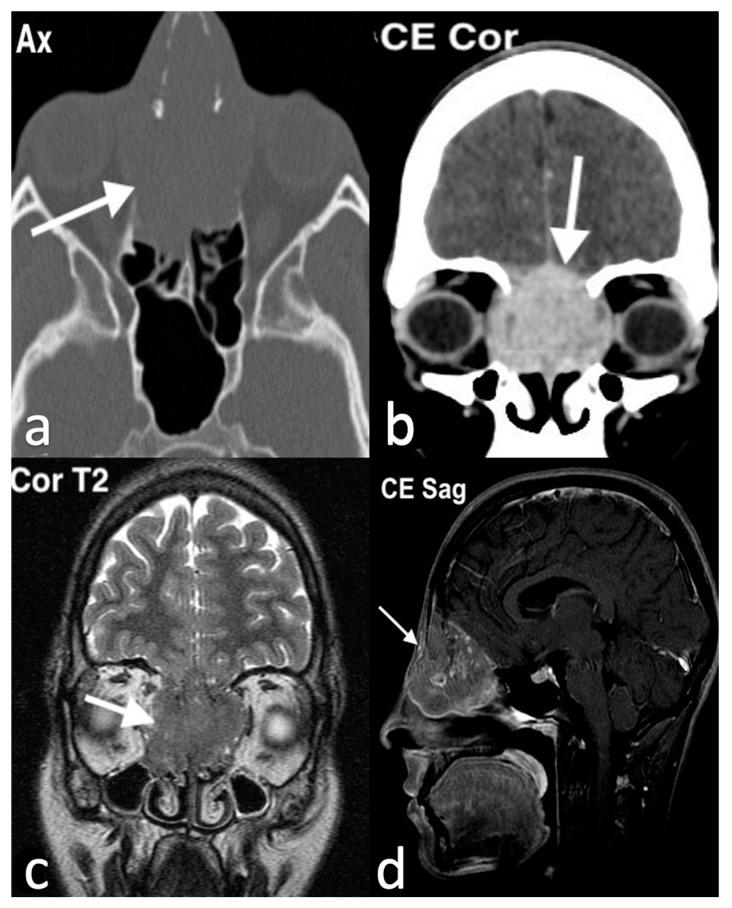 https://cdn.ncbi.nlm.nih.gov/pmc/blobs/8316/11676659/028d56d6bf54/jpm-14-01145-g015.jpg