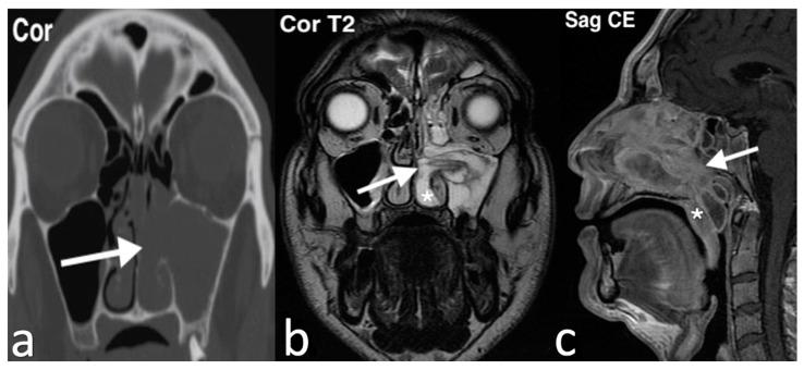 https://cdn.ncbi.nlm.nih.gov/pmc/blobs/8316/11676659/0473df5c8355/jpm-14-01145-g011.jpg