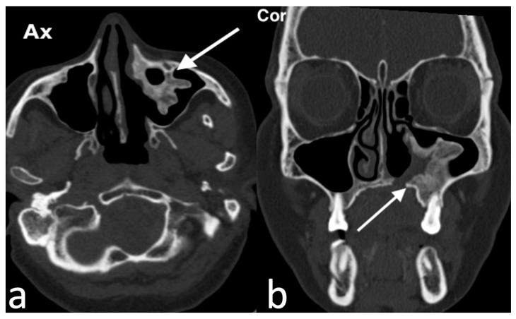 https://cdn.ncbi.nlm.nih.gov/pmc/blobs/8316/11676659/158699466826/jpm-14-01145-g006.jpg