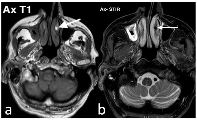 https://cdn.ncbi.nlm.nih.gov/pmc/blobs/8316/11676659/1da44625af34/jpm-14-01145-g012.jpg