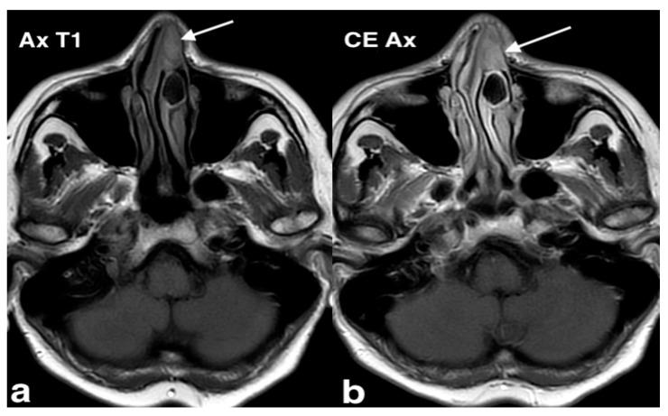 https://cdn.ncbi.nlm.nih.gov/pmc/blobs/8316/11676659/22a5fc0a110e/jpm-14-01145-g017.jpg