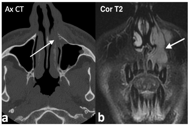 https://cdn.ncbi.nlm.nih.gov/pmc/blobs/8316/11676659/3ad31d3f377e/jpm-14-01145-g014.jpg