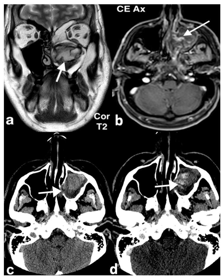 https://cdn.ncbi.nlm.nih.gov/pmc/blobs/8316/11676659/58d293416a18/jpm-14-01145-g013.jpg