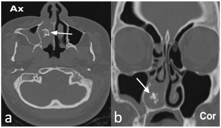 https://cdn.ncbi.nlm.nih.gov/pmc/blobs/8316/11676659/689f44d12141/jpm-14-01145-g002.jpg