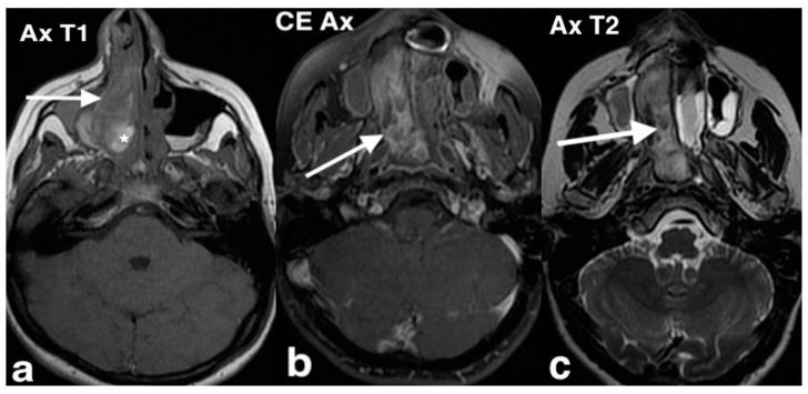 https://cdn.ncbi.nlm.nih.gov/pmc/blobs/8316/11676659/856d1eeaf192/jpm-14-01145-g009.jpg