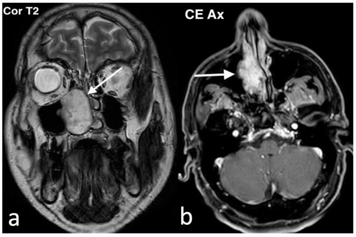 https://cdn.ncbi.nlm.nih.gov/pmc/blobs/8316/11676659/8af92e7fe079/jpm-14-01145-g004.jpg