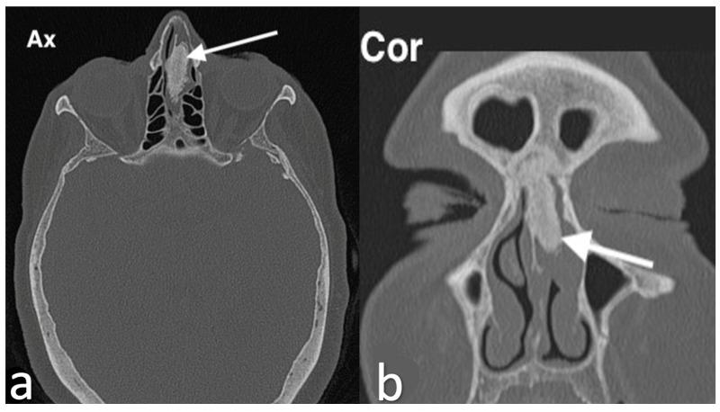 https://cdn.ncbi.nlm.nih.gov/pmc/blobs/8316/11676659/a9a9a91cea2c/jpm-14-01145-g008.jpg