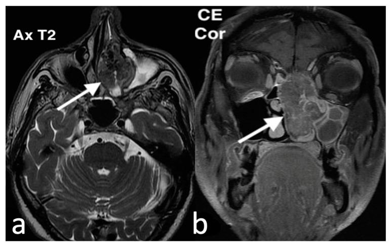 https://cdn.ncbi.nlm.nih.gov/pmc/blobs/8316/11676659/ad57c6579a08/jpm-14-01145-g016.jpg