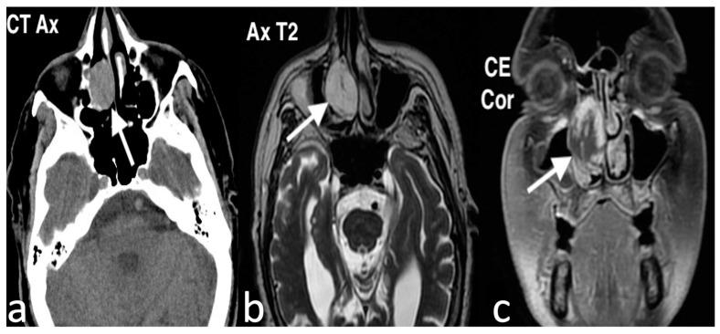 https://cdn.ncbi.nlm.nih.gov/pmc/blobs/8316/11676659/c0b89359be51/jpm-14-01145-g010.jpg