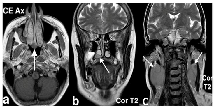 https://cdn.ncbi.nlm.nih.gov/pmc/blobs/8316/11676659/c1e90bb57f85/jpm-14-01145-g018.jpg