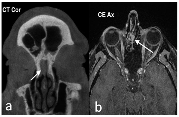 https://cdn.ncbi.nlm.nih.gov/pmc/blobs/8316/11676659/e3d16b645d6c/jpm-14-01145-g005.jpg