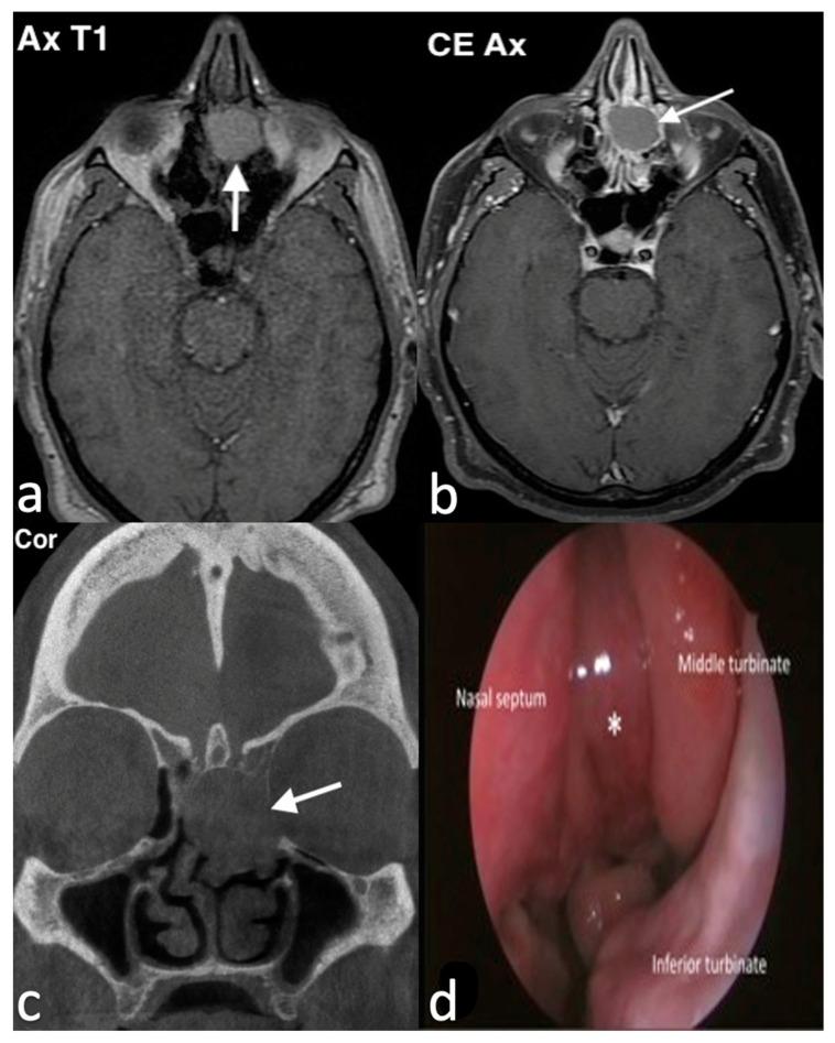 https://cdn.ncbi.nlm.nih.gov/pmc/blobs/8316/11676659/fa807b52426f/jpm-14-01145-g001.jpg