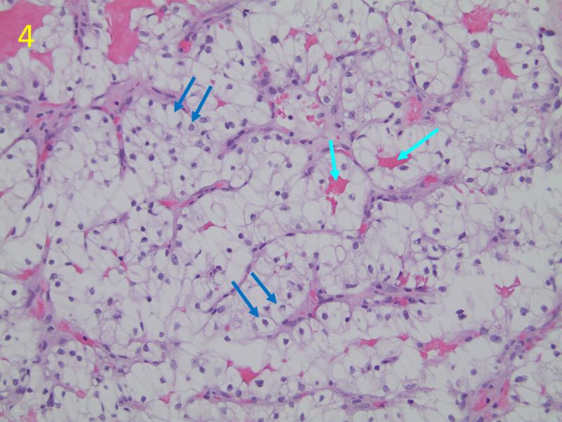 https://cdn.ncbi.nlm.nih.gov/pmc/blobs/831c/7553794/48520bb714b9/cureus-0012-00000010428-i04.jpg