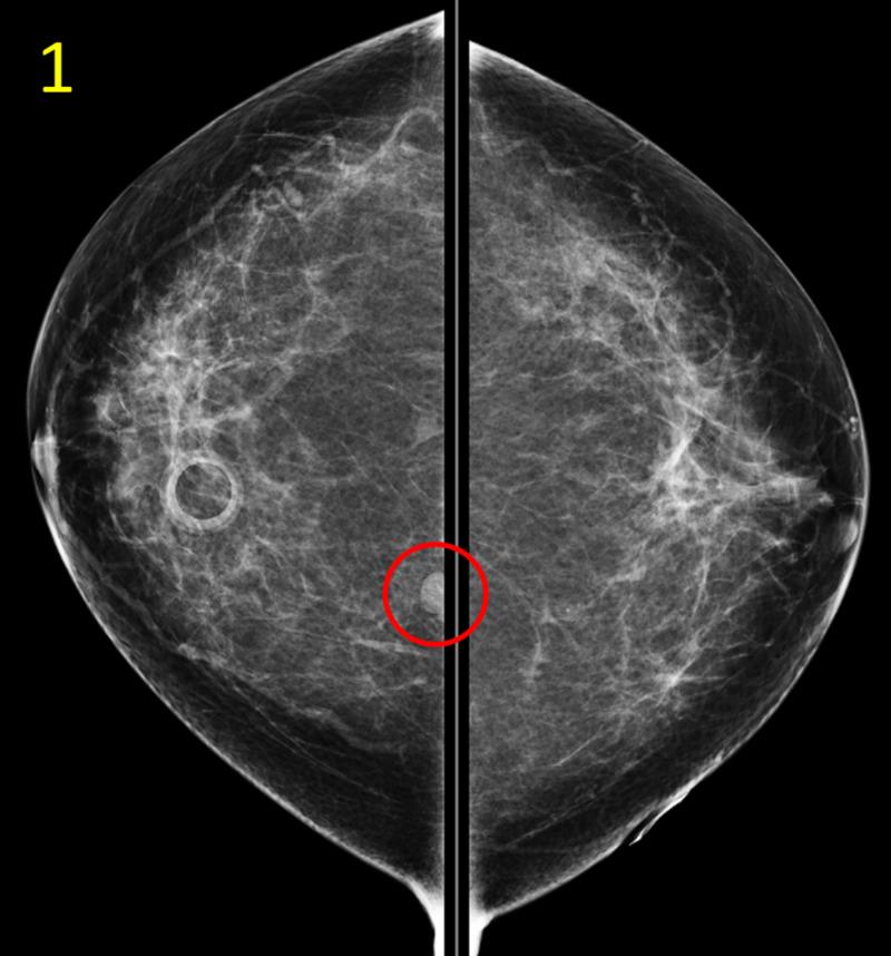 https://cdn.ncbi.nlm.nih.gov/pmc/blobs/831c/7553794/8bbb21990108/cureus-0012-00000010428-i01.jpg
