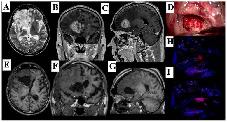 https://cdn.ncbi.nlm.nih.gov/pmc/blobs/8323/12191055/40595f116855/cancers-17-01897-g005.jpg