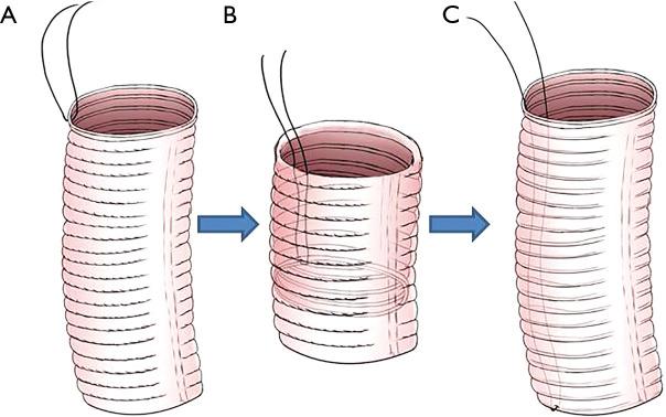 https://cdn.ncbi.nlm.nih.gov/pmc/blobs/8326/7947529/8037e71bcaff/jtd-13-02-533-f1.jpg