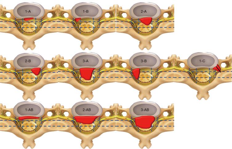 https://cdn.ncbi.nlm.nih.gov/pmc/blobs/8327/10423346/bc94091045e8/qims-13-08-4984-f2.jpg