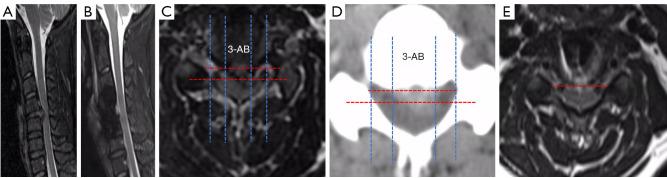 https://cdn.ncbi.nlm.nih.gov/pmc/blobs/8327/10423346/ce908c256374/qims-13-08-4984-f4.jpg