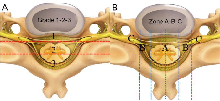 https://cdn.ncbi.nlm.nih.gov/pmc/blobs/8327/10423346/f5ecb1fd5635/qims-13-08-4984-f1.jpg