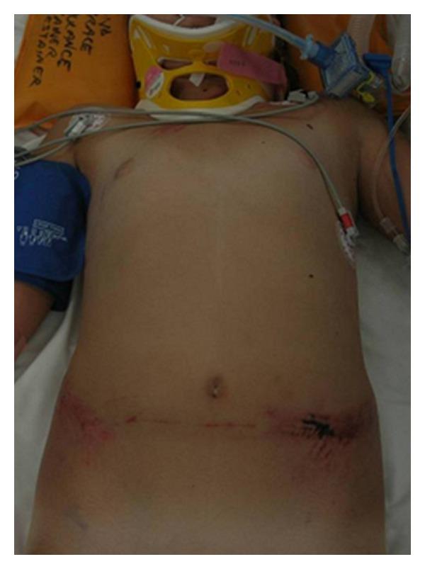 https://cdn.ncbi.nlm.nih.gov/pmc/blobs/8337/3350007/bb41234669c5/CRIM.PEDIATRICS2012-326936.001.jpg