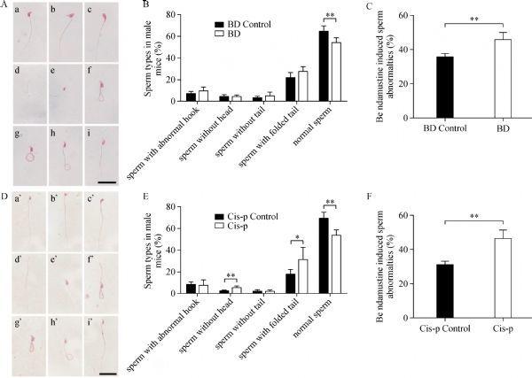https://cdn.ncbi.nlm.nih.gov/pmc/blobs/8337/6283825/4ee9ebe8acb6/jbr-32-6-442-fig7.jpg
