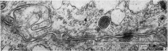 https://cdn.ncbi.nlm.nih.gov/pmc/blobs/8338/1270795/22bc3a811cf2/janat00415-0089-b.jpg