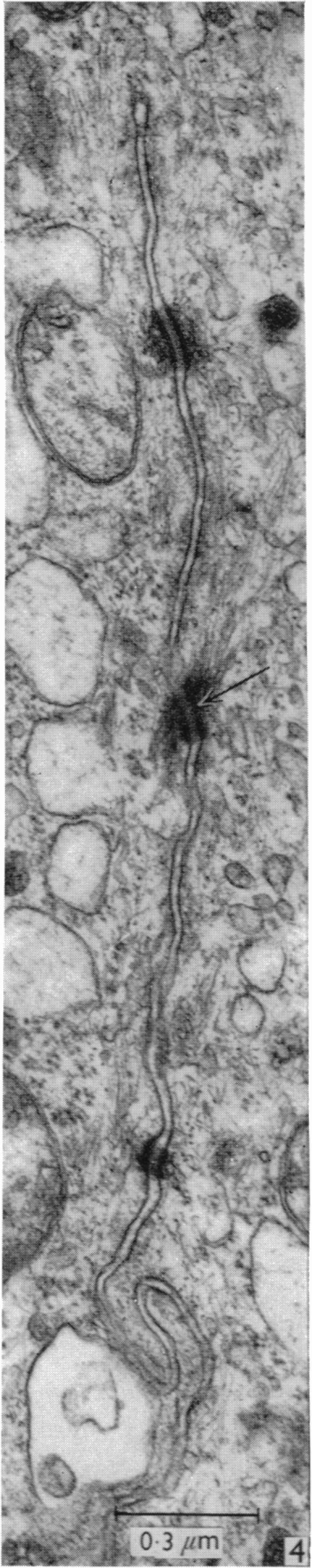 https://cdn.ncbi.nlm.nih.gov/pmc/blobs/8338/1270795/948b2b709d33/janat00415-0091-b.jpg