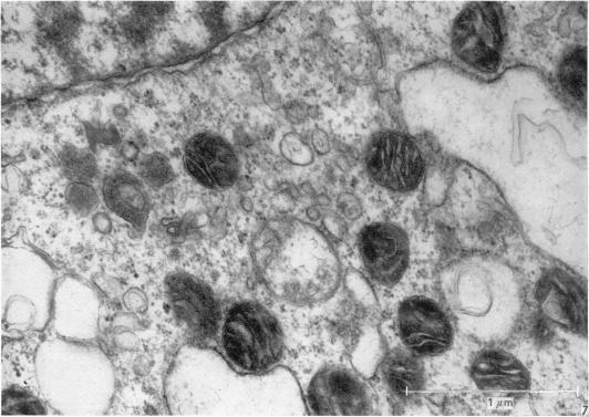 https://cdn.ncbi.nlm.nih.gov/pmc/blobs/8338/1270795/b2acbcc8bd0d/janat00415-0095-a.jpg