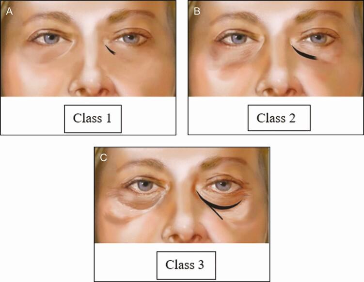 https://cdn.ncbi.nlm.nih.gov/pmc/blobs/833c/8728712/cfd876b6abc2/ojab038_fig1.jpg