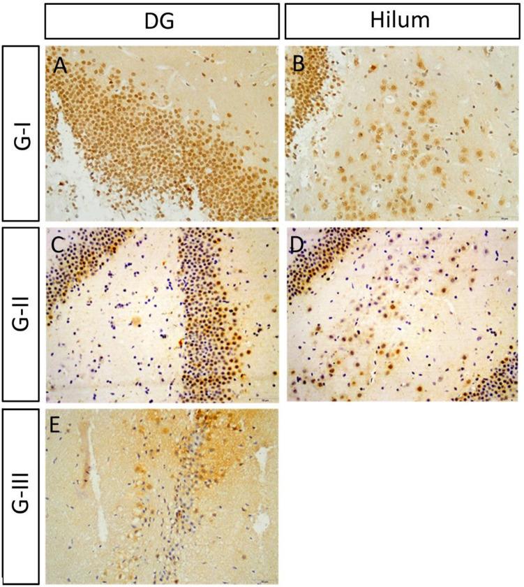 https://cdn.ncbi.nlm.nih.gov/pmc/blobs/833f/9551060/8bdcf803abf4/41598_2022_20963_Fig9_HTML.jpg