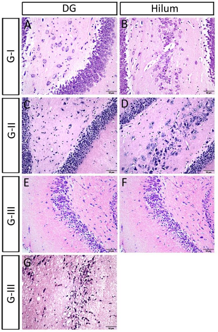 https://cdn.ncbi.nlm.nih.gov/pmc/blobs/833f/9551060/f45459f30fc4/41598_2022_20963_Fig4_HTML.jpg