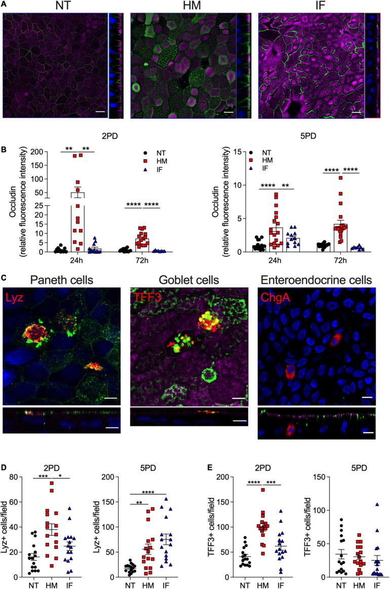 https://cdn.ncbi.nlm.nih.gov/pmc/blobs/8359/8313895/d5cbb1c0e179/fcell-09-685171-g003.jpg