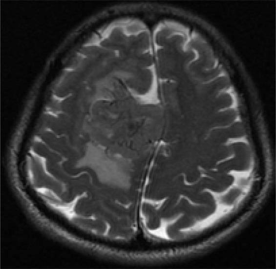 https://cdn.ncbi.nlm.nih.gov/pmc/blobs/8360/6306993/c8231132f154/AFHS1803-0799Fig2a.jpg
