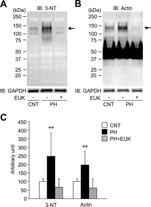 https://cdn.ncbi.nlm.nih.gov/pmc/blobs/836b/5289453/834a8edcb6f2/pone.0169146.g005.jpg