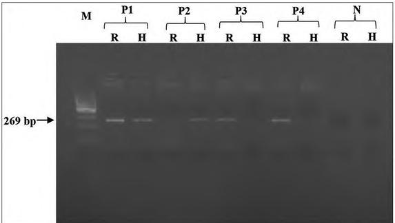 https://cdn.ncbi.nlm.nih.gov/pmc/blobs/836b/7474221/8eecfc32c671/bjmg-23-069-g002.jpg