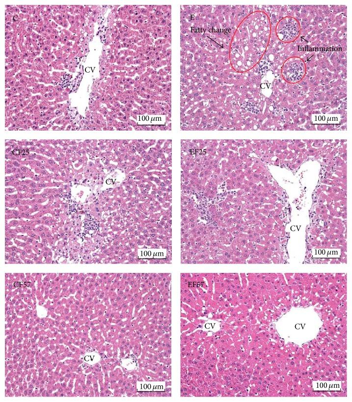 https://cdn.ncbi.nlm.nih.gov/pmc/blobs/8370/4842064/39fb7793c89f/GRP2016-4694726.001.jpg