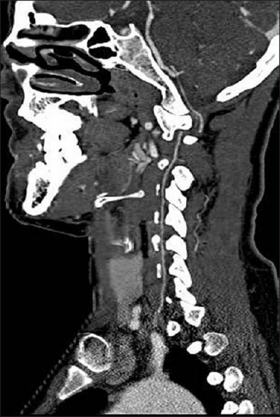 https://cdn.ncbi.nlm.nih.gov/pmc/blobs/8377/3086173/90c971bdc4cb/SNI-2-39-g008.jpg