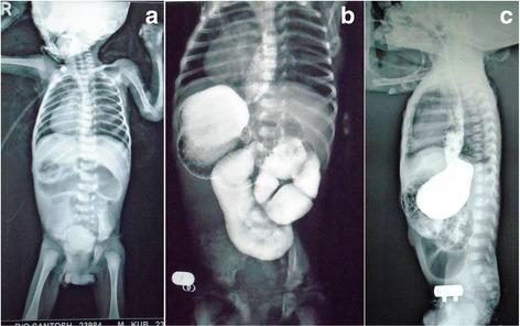 https://cdn.ncbi.nlm.nih.gov/pmc/blobs/8379/5603179/5f997067c4c5/13256_2017_1423_Fig1_HTML.jpg