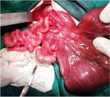 https://cdn.ncbi.nlm.nih.gov/pmc/blobs/8379/5603179/8fd74a1f1e31/13256_2017_1423_Fig4_HTML.jpg